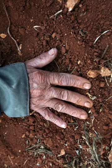 Senior Man Hands with scratches